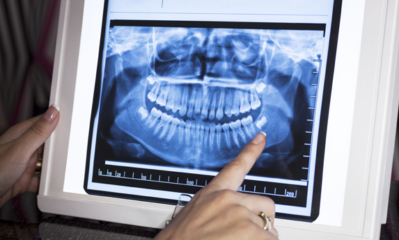Why Are Dental X Rays Needed.jpg
